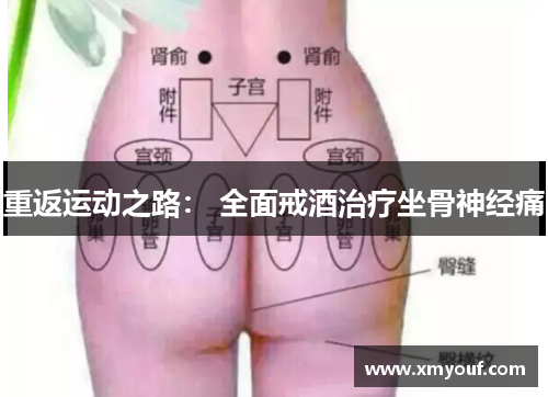 重返运动之路： 全面戒酒治疗坐骨神经痛
